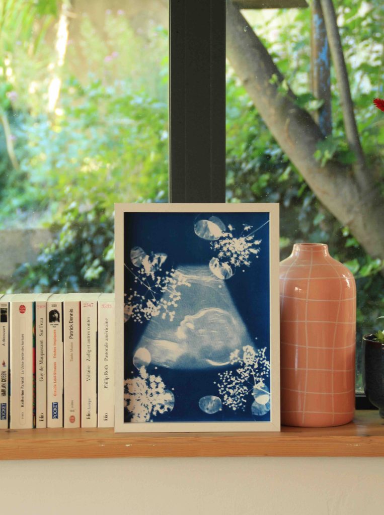 echographie cyanotype encadré cyrielle grassi